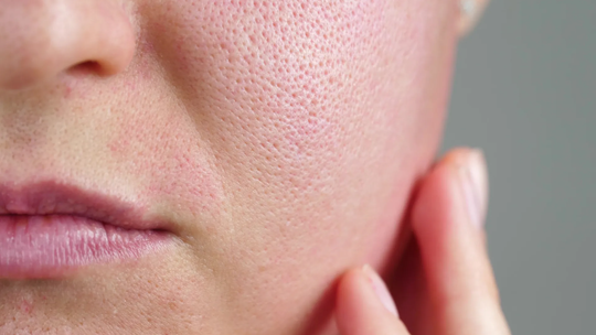 Bariera hydrolipidowa – budowa, funkcje i sposoby regeneracji Bariera hydrolipidowa – budowa, funkcje i sposoby regeneracji