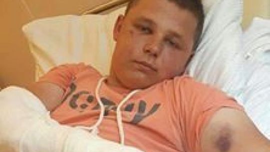 Brutalne pobicie na ul. 1905 Roku