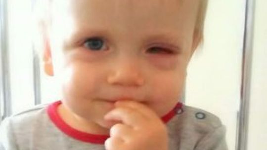 By ratować oko chłopca, zagrają w piłkę