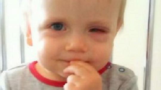 CHŁOPCU GROZI UTRATA OKA. POTRZEBNE PIENIĄDZE CHŁOPCU GROZI UTRATA OKA. POTRZEBNE PIENIĄDZE