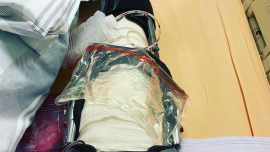 Damian Jakubik po operacji. Teraz czeka go długa rehabilitacja