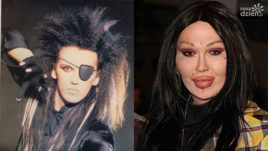 DEAD OR ALIVE: PETE BURNS  WOKALISTA KULTOWEJ FORMACJI NIE ŻYJE