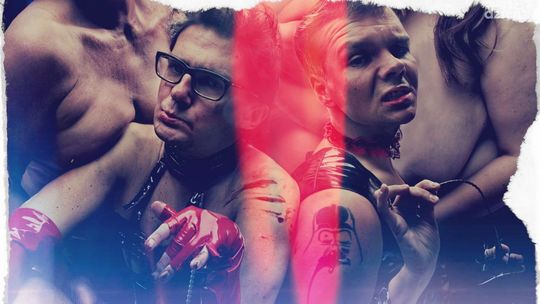 FIGURSKI POTRZEBUJE PRZESZCZEPU NERKI?