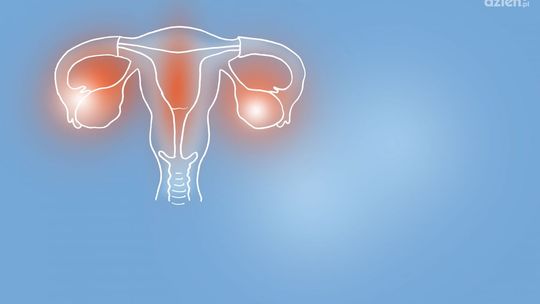 Histeroskopia operacyjna, czyli mało inwazyjna metoda leczenia