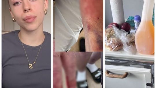 Influencerka oskarża szpital na Józefowie o zaniedbania w opiece nad ojcem [AKTUALIZACJA]