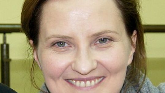 Iza Kuna o skalpelu na twarzy