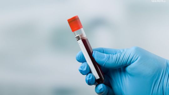 Jak często należy badać krew?