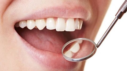 Jak zapobiegać chorobom zębów?