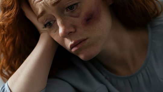 Masz dość bycia ofiarą narcyza?