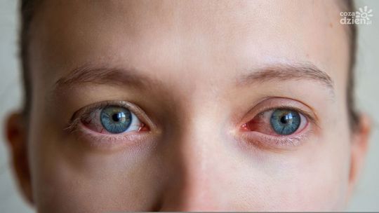 Najczęstsze choroby oczu