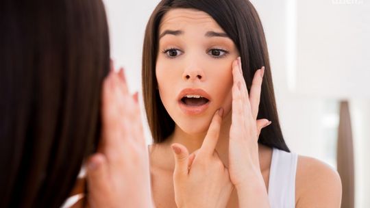 Najlepsze kosmetyki na trądzik – ranking TOP 5