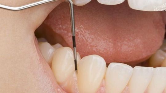 Paradontozie mówimy "nie" Odcinek 11