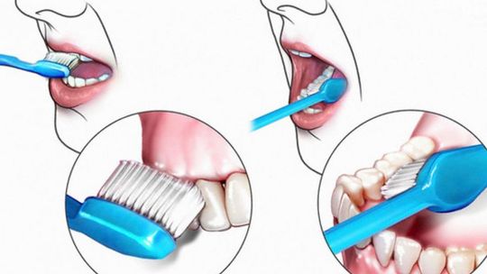 Paradontozie mówimy "nie" odcinek 5 Wpływ higieny jamy ustnej na rozwój i postęp paradontozy cz.1
