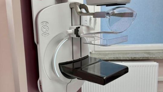 Ten sprzęt może uratować życie. Nowy mammograf na Józefowie