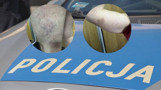 W komendzie policji w Kozienicach doszło do pobicia? Trwa dochodzenie