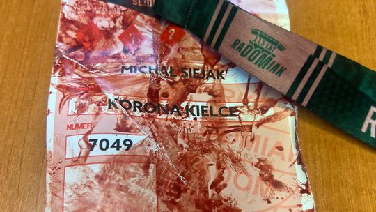 Zraniony dyrektor Korony o incydentach w Radomiu: - Doszło do poważnych naruszeń bezpieczeństwa