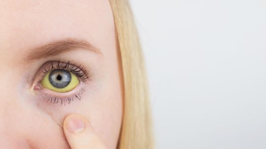 Zdążyć przed żółtym