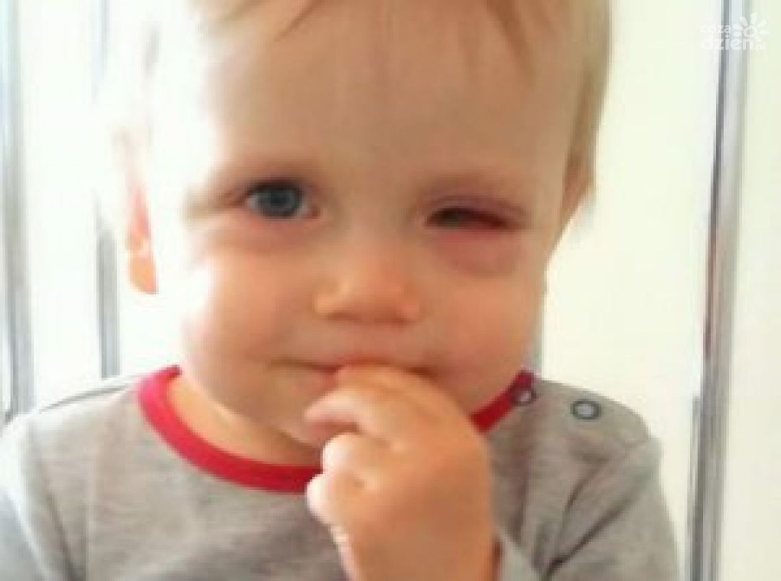 By ratować oko chłopca, zagrają w piłkę