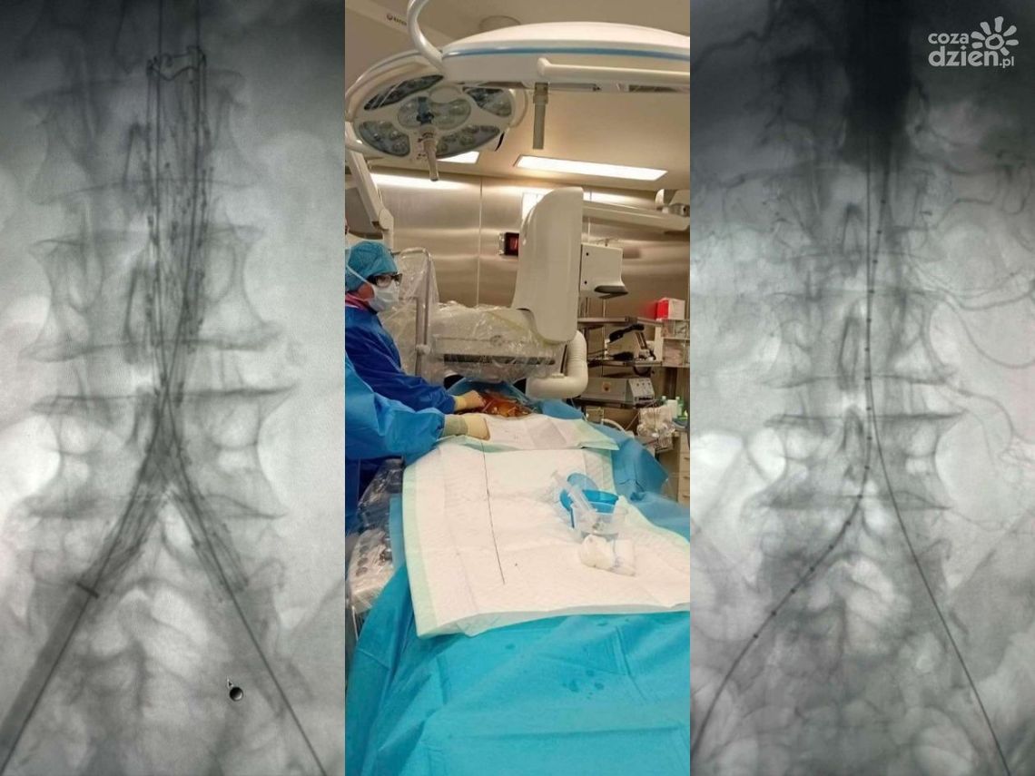 Chirurgia naczyniowa na Józefowie wkracza na nowy poziom