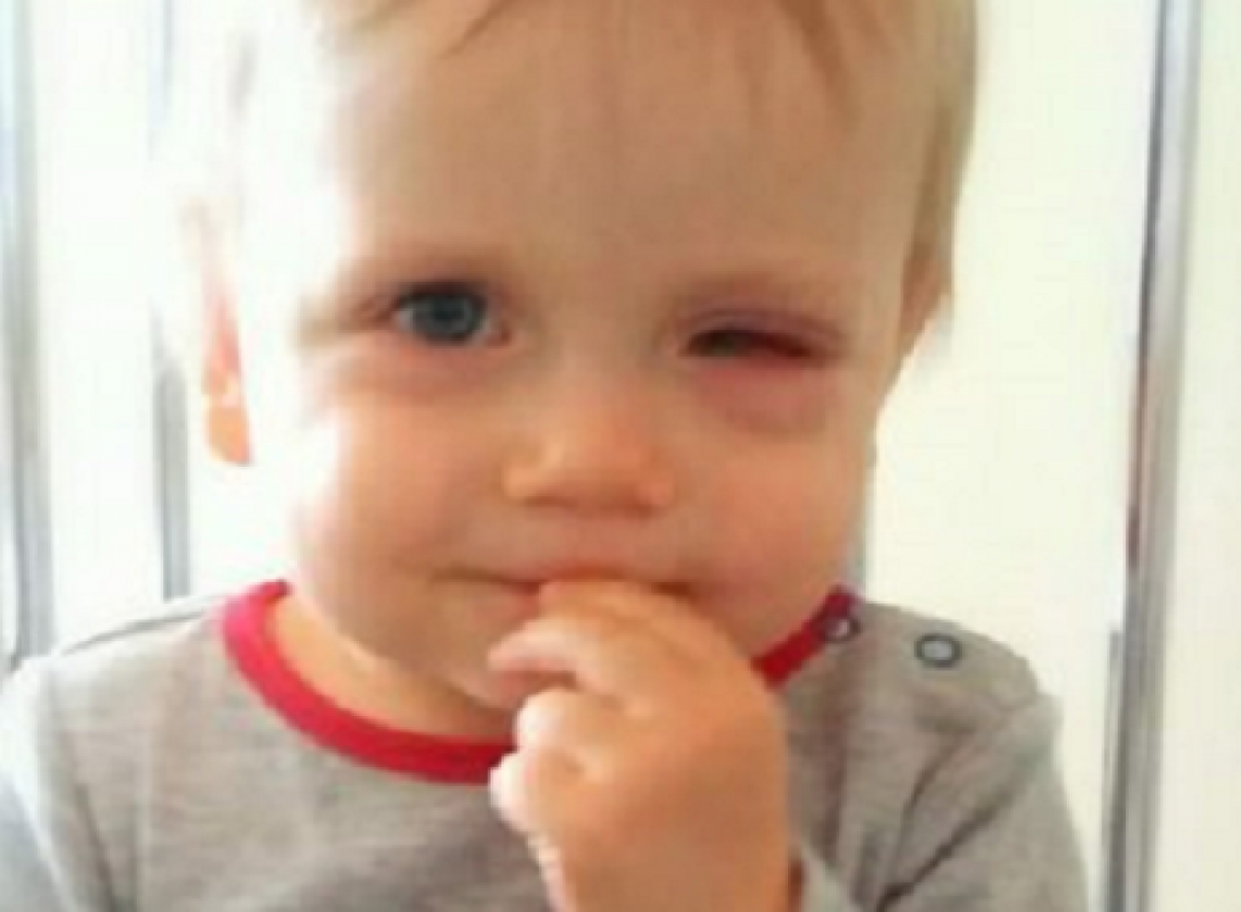 CHŁOPCU GROZI UTRATA OKA. POTRZEBNE PIENIĄDZE