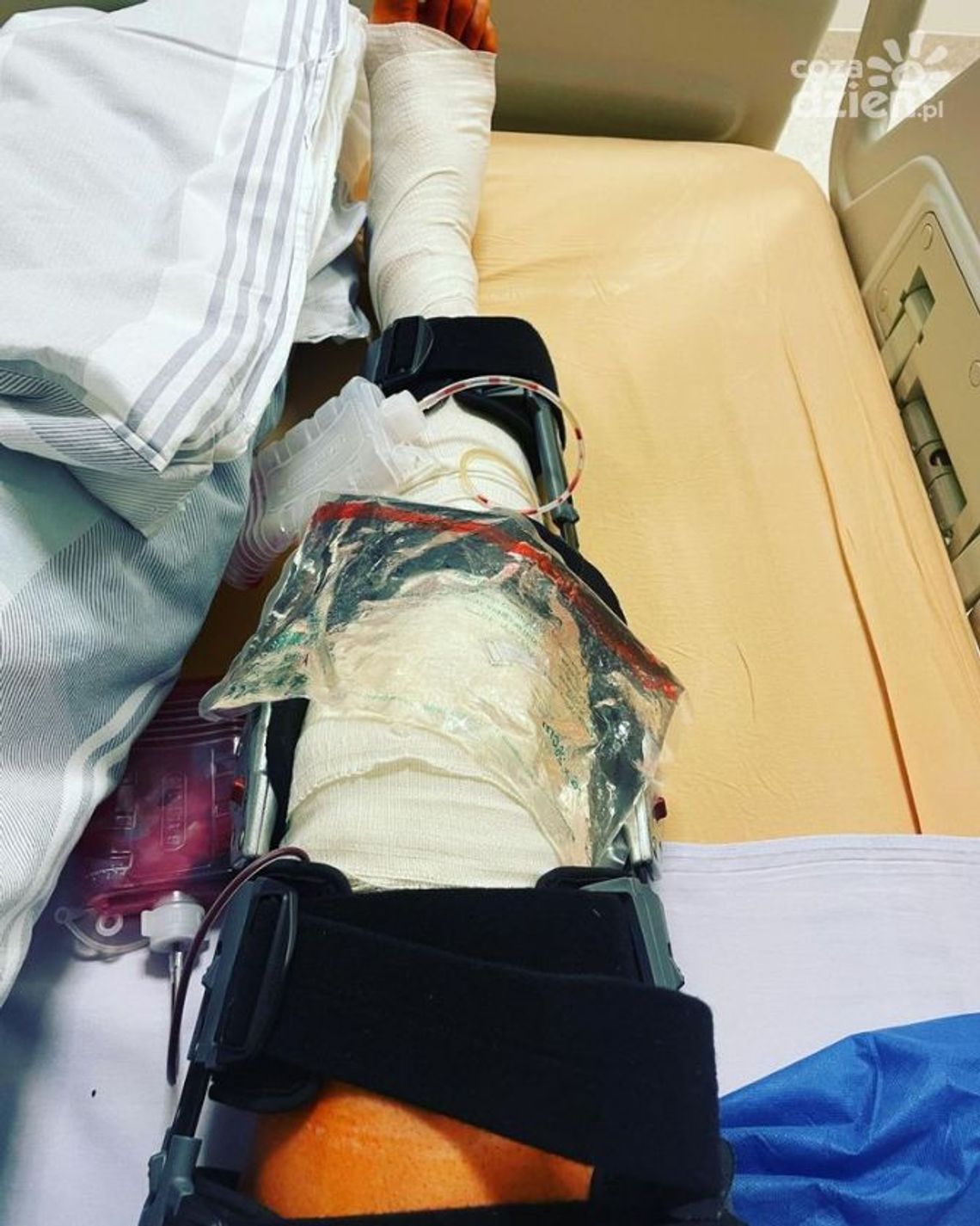 Damian Jakubik po operacji. Teraz czeka go długa rehabilitacja