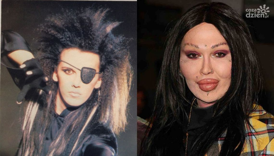 DEAD OR ALIVE: PETE BURNS  WOKALISTA KULTOWEJ FORMACJI NIE ŻYJE
