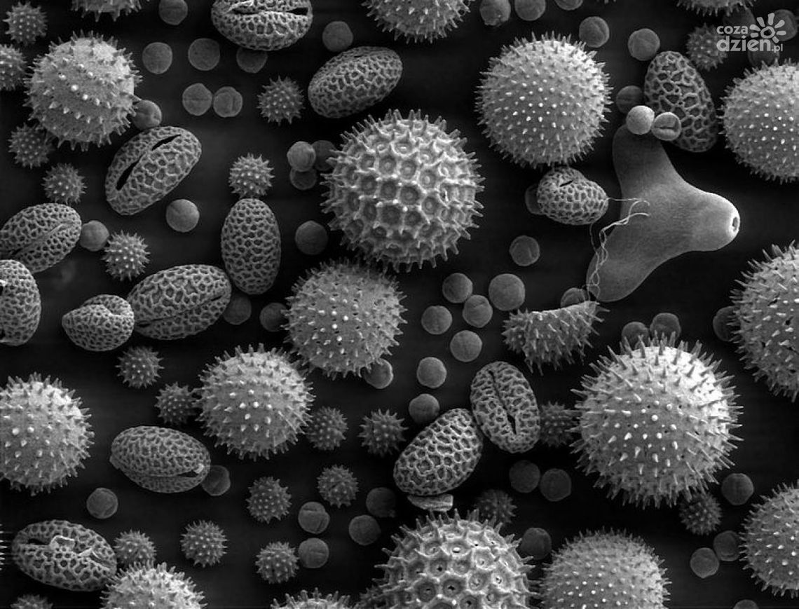 Gdy twoje dziecko ma alergię... Jak urządzić mu pokój?