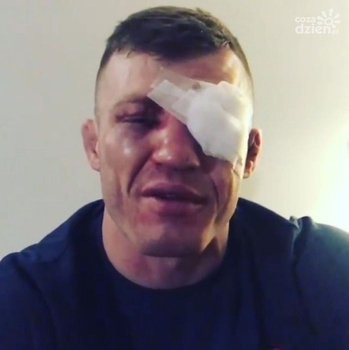 Krwawa porażka Odzimkowskiego na KSW 52 Krwawa porażka Odzimkowskiego na KSW 52