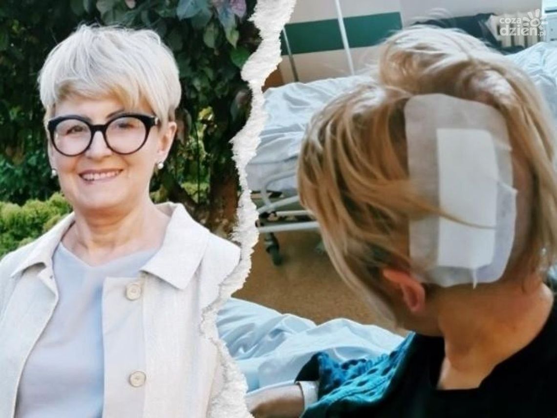 Lekarka z Radomia ma guza mózgu. Potrzebuje pomocy 