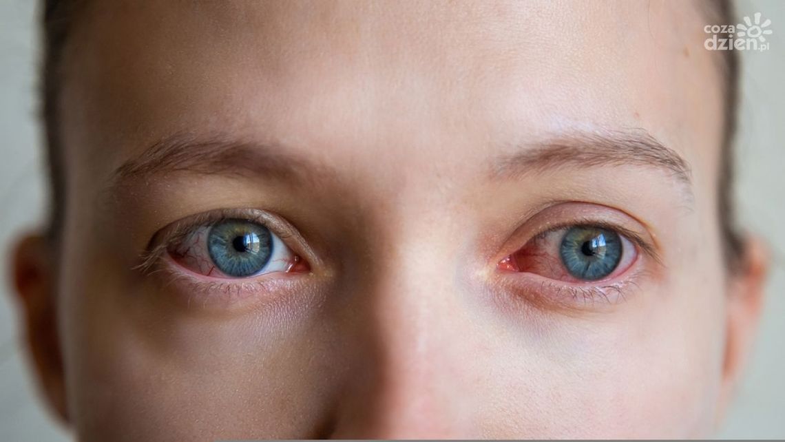 Najczęstsze choroby oczu