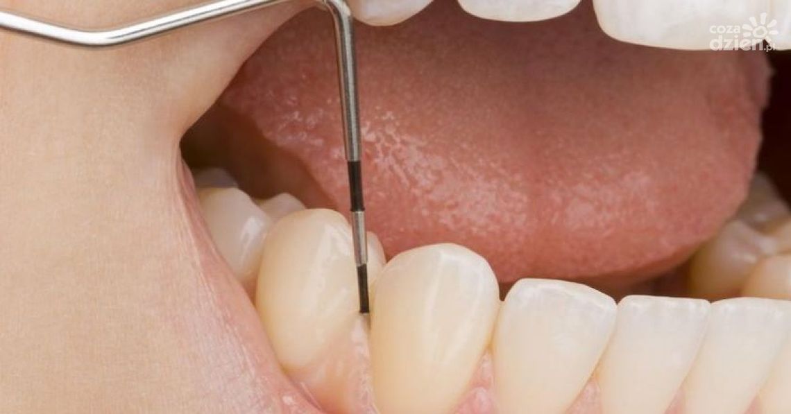 Paradontozie mówimy "nie" Odcinek 11 Paradontozie mówimy "nie" Odcinek 11