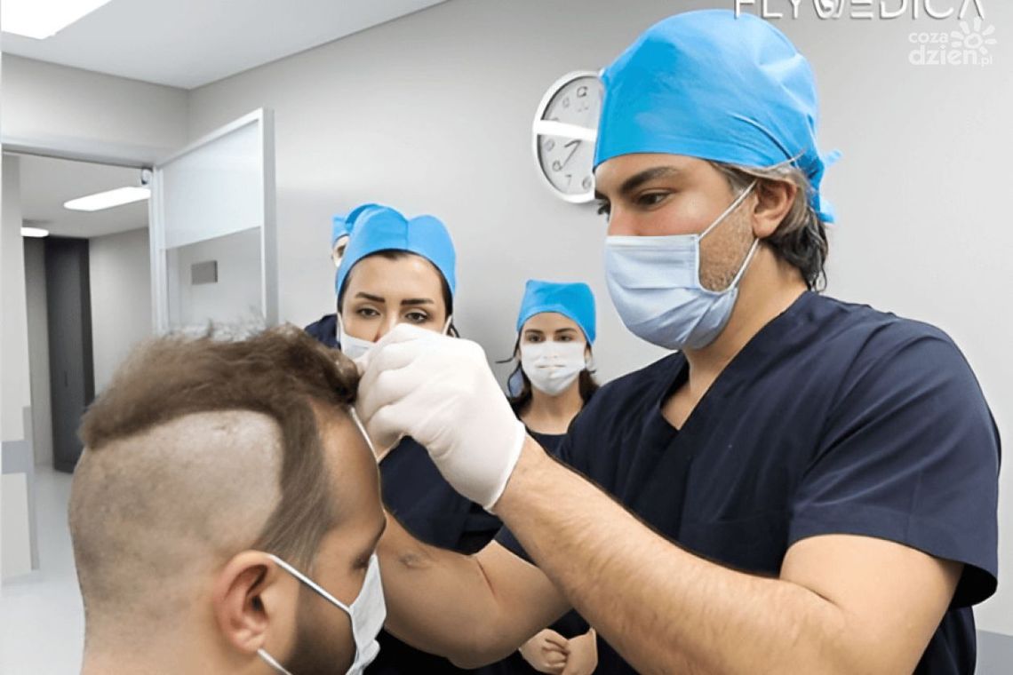 Przeszczep włosów — Przegląd dostępnych metod i technologii