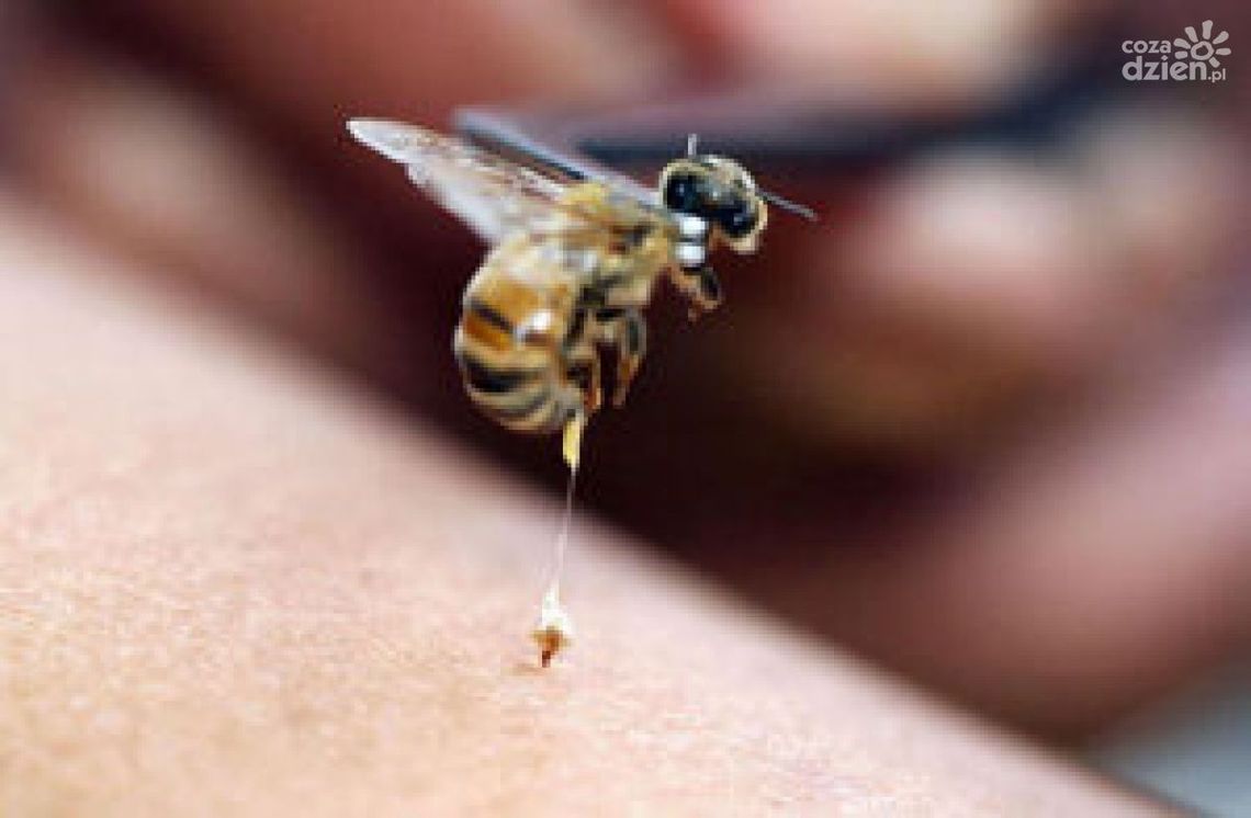 Sposoby na ukąszenia owadów