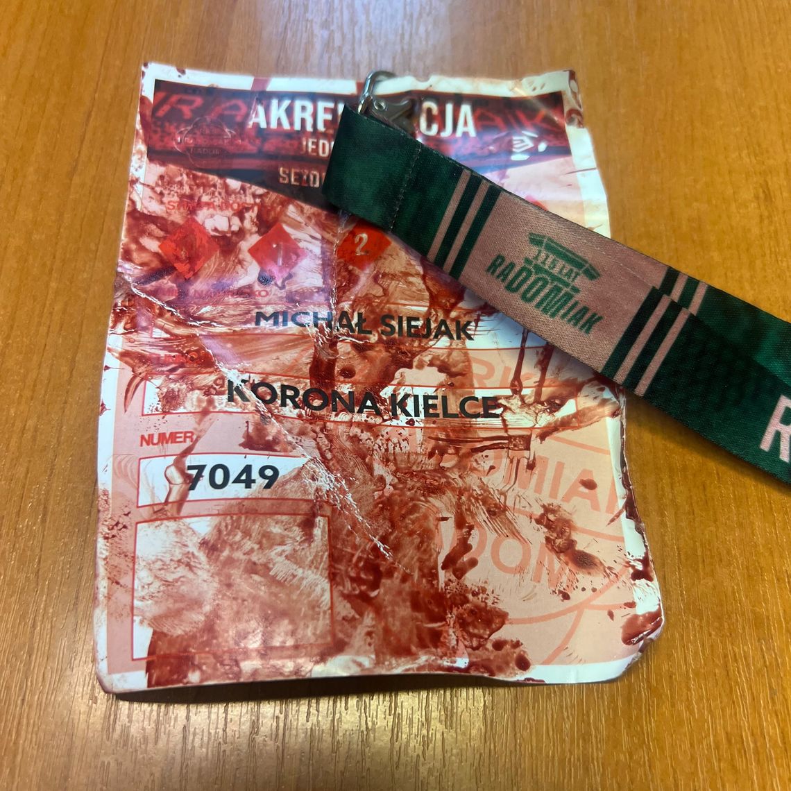 Zraniony dyrektor Korony o incydentach w Radomiu: - Doszło do poważnych naruszeń bezpieczeństwa