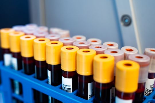 Zbiórka krwi dla małej Mai (zdjęcia)