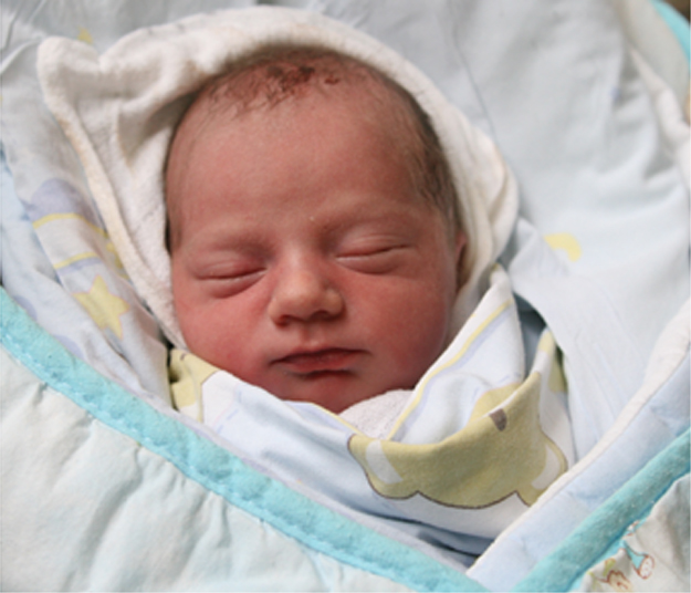 Iwo Brzyski Iwo Brzyski